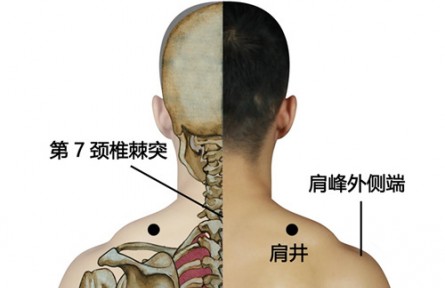 ?健康問(wèn)答 | 緩解頸椎“職業(yè)病”，如何進(jìn)行中醫(yī)調(diào)理？