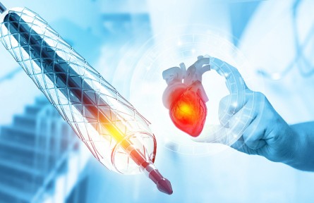 科技名詞 | 形狀記憶聚合物  shape memory polymers，SMP