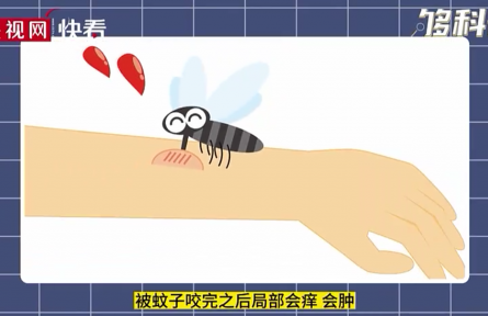 被蚊子叮咬后會(huì)越撓越癢嗎？