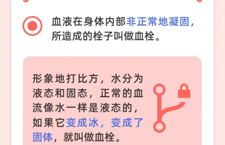 世界血栓日：血栓最易“栓”住哪些人？
