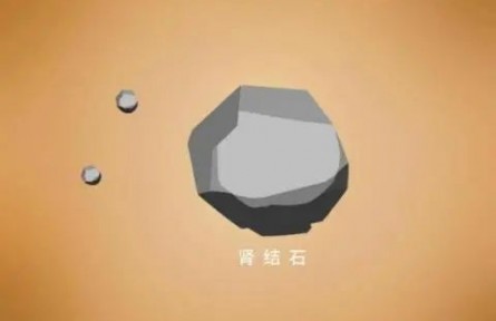 辟謠|腎結(jié)石患者不能補鈣？菠菜燉豆腐都不能吃了？