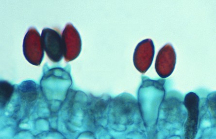 科技名詞|芽孢 spore，gemma